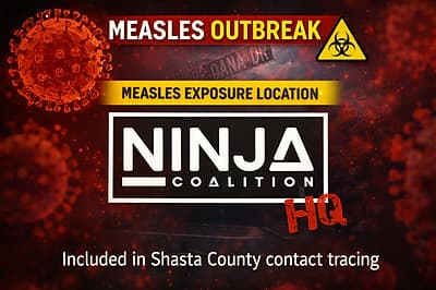 New measles exposure site tied to business owned by Shasta County supervisor